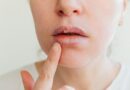 Emiten recomendaciones para tratar el herpes labial
